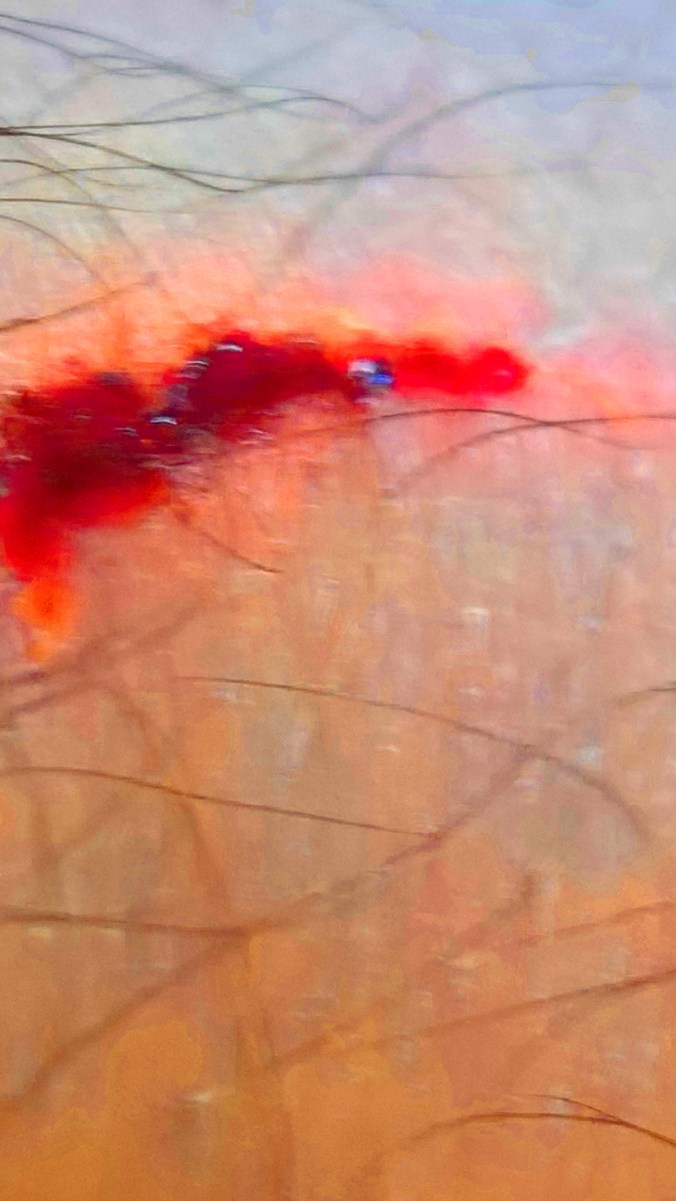 Sight_2017_04_08_162605_960